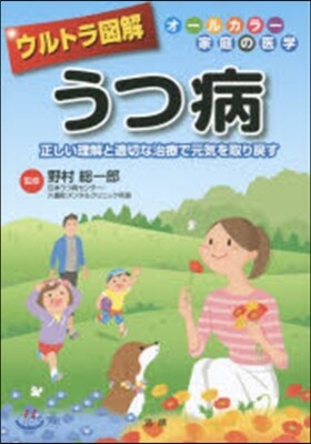 ウルトラ圖解 うつ病