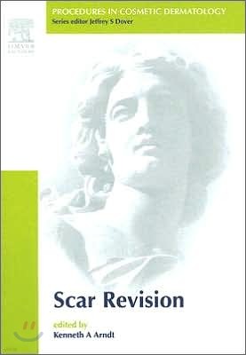 Procedures in Cosmetic Dermatology : Scar Revision