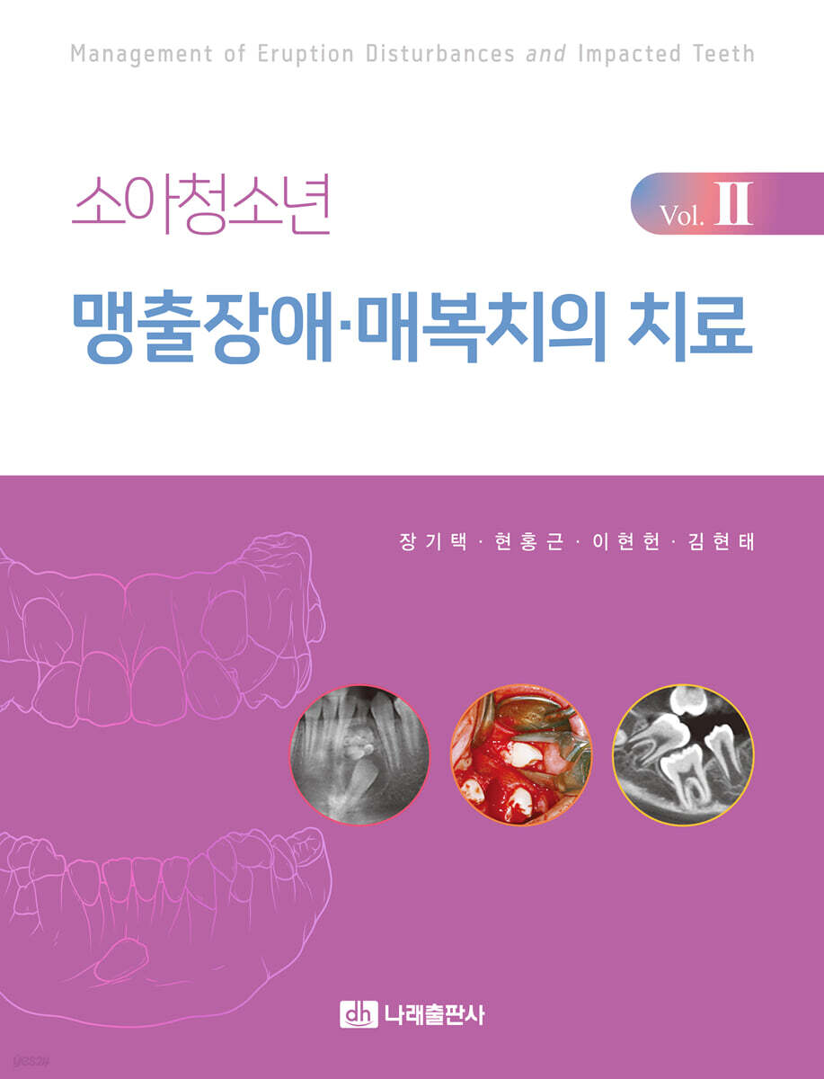 소아청소년 맹출장애·매복치의 치료 Vol.2