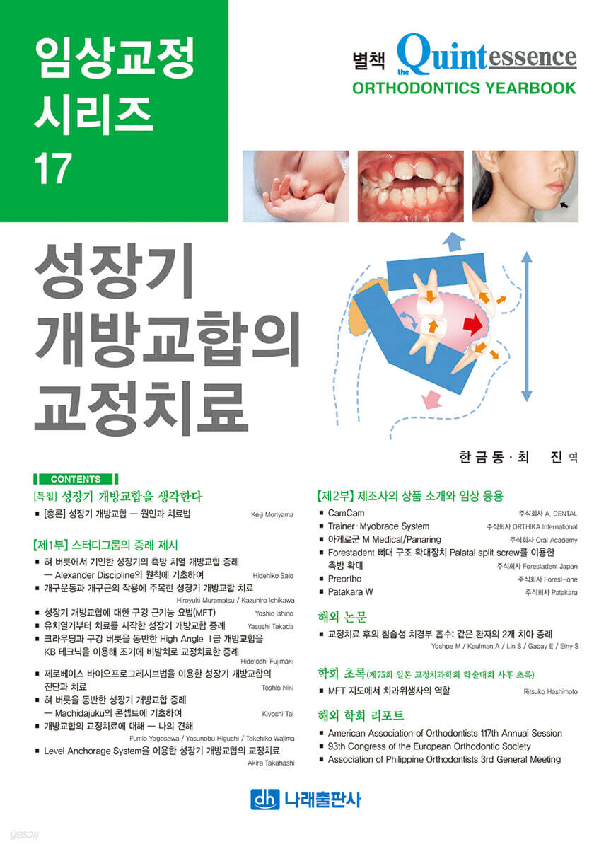 성장기 개방교합의 교정치료