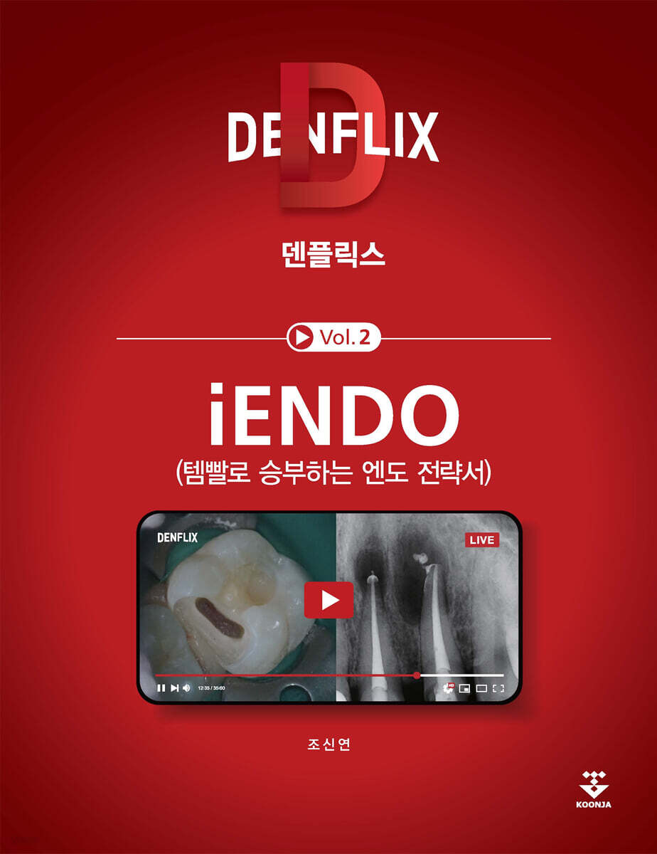 덴플릭스 iENDO (템빨로 승부하는 엔도 전략서) Vol.2