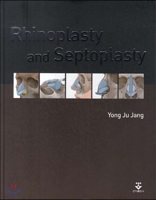 Rhinoplasty and Septoplasty