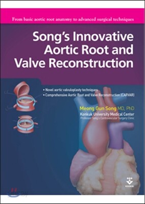 Song's Innovative Aortic Root and Valve Reconstruction
