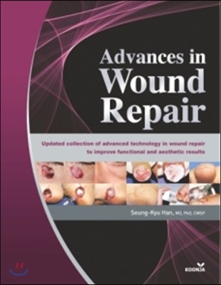 Advances in Wound Repair