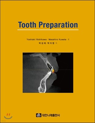 Tooth Preparation 