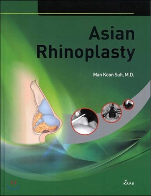 Asian Rhinoplasty