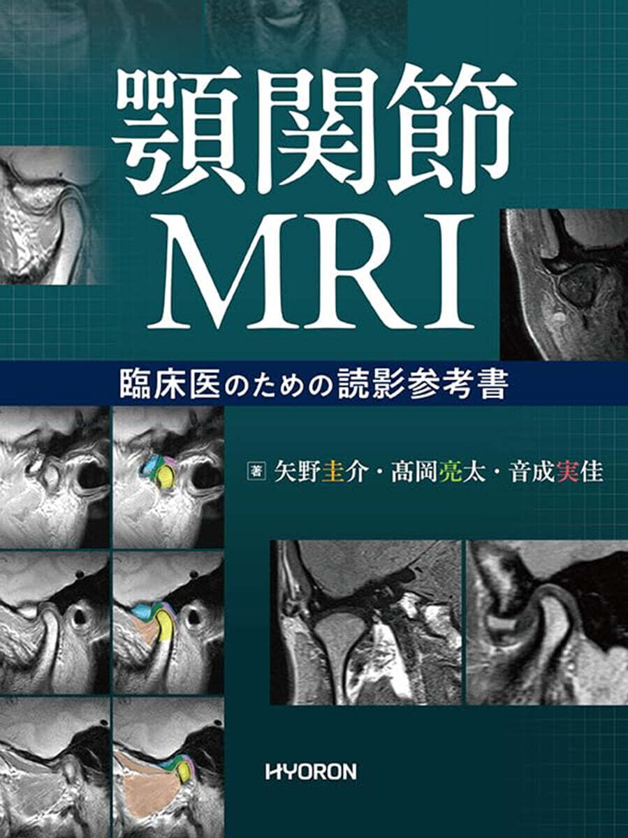 顎関節MRI