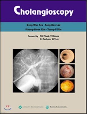 Cholangioscopy