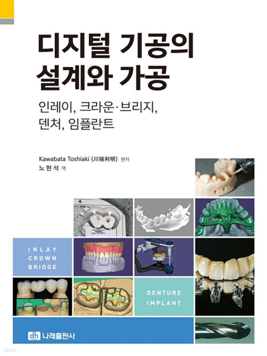 디지털 기공의 설계와 가공