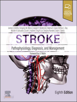 Stroke: Pathophysiology, Diagnosis, and Management: Pathophysiology, Diagnosis, and Management
