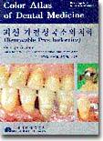 [중고-중] 최신 가철성국소의치학