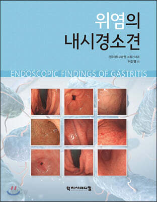 위염의 내시경소견