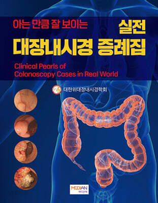 아는 만큼 잘 보이는 실전 대장내시경 증례집