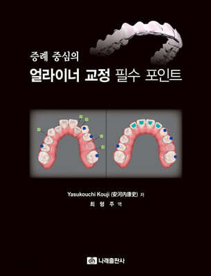 증례 중심의 얼라이너 교정 필수 포인트