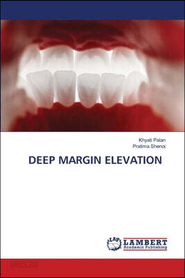 DEEP MARGIN ELEVATION