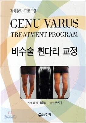 비수술 휜다리 교정