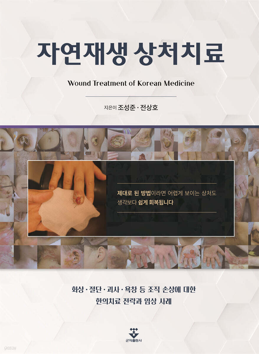 [대여] 자연재생 상처치료