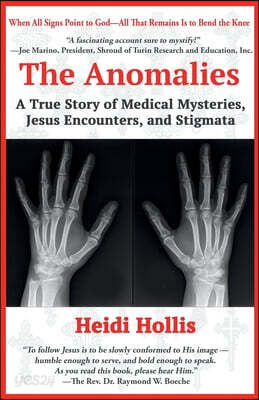 The Anomalies: A True Story of Medical Mysteries, Jesus Encounters, and Stigmata