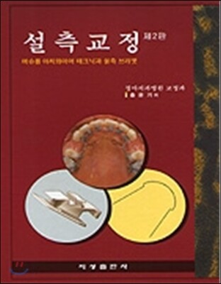 설측교정