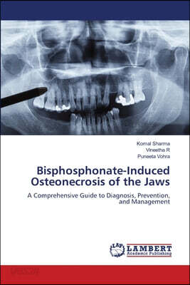 Bisphosphonate-Induced Osteonecrosis of the Jaws
