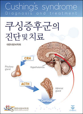 쿠싱증후군의 진단 및 치료