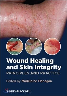Wound Healing and Skin Integrity