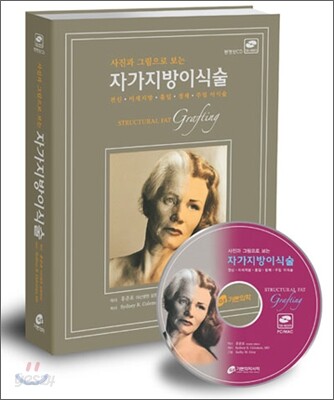 사진과 그림으로 보는 자가지방 이식술