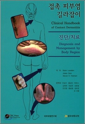 접촉 피부염 길라잡이