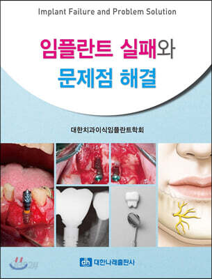 임플란트 실패와 문제점 해결