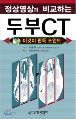 [중고-최상] 정상영상과 비교하는 두부 CT