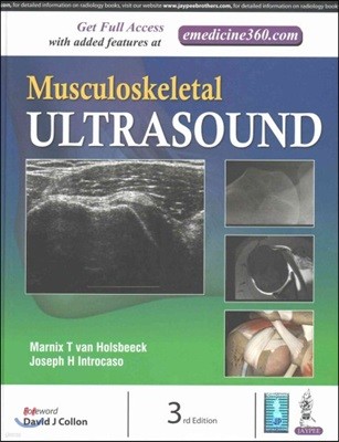 Musculoskeletal Ultrasound