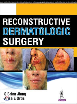 Jp Medical Pub Reconstructive Dermatologic Surgery