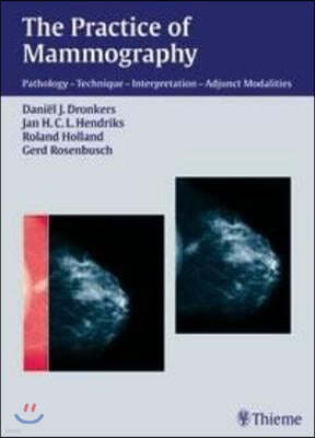 Practice of Mammography