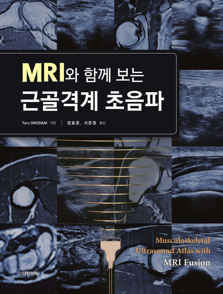 MRI와 함께 보는 근골격계 초음파