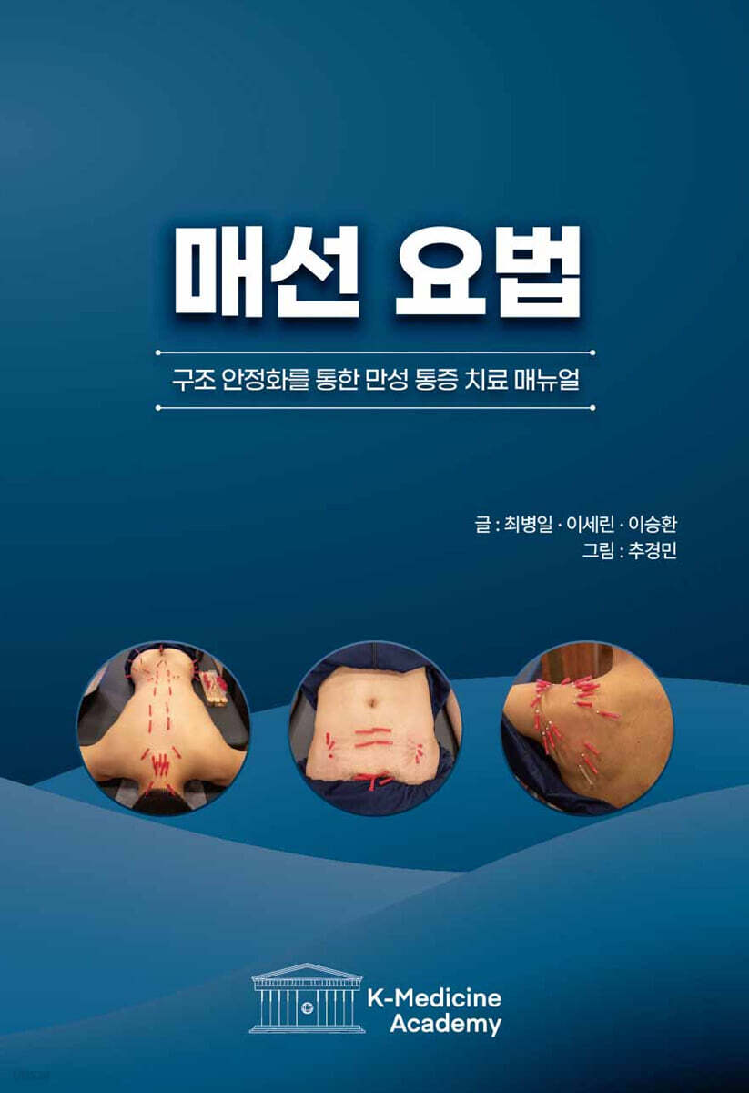 매선 요법