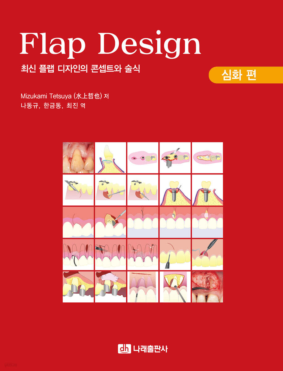 Flap Design 심화 편