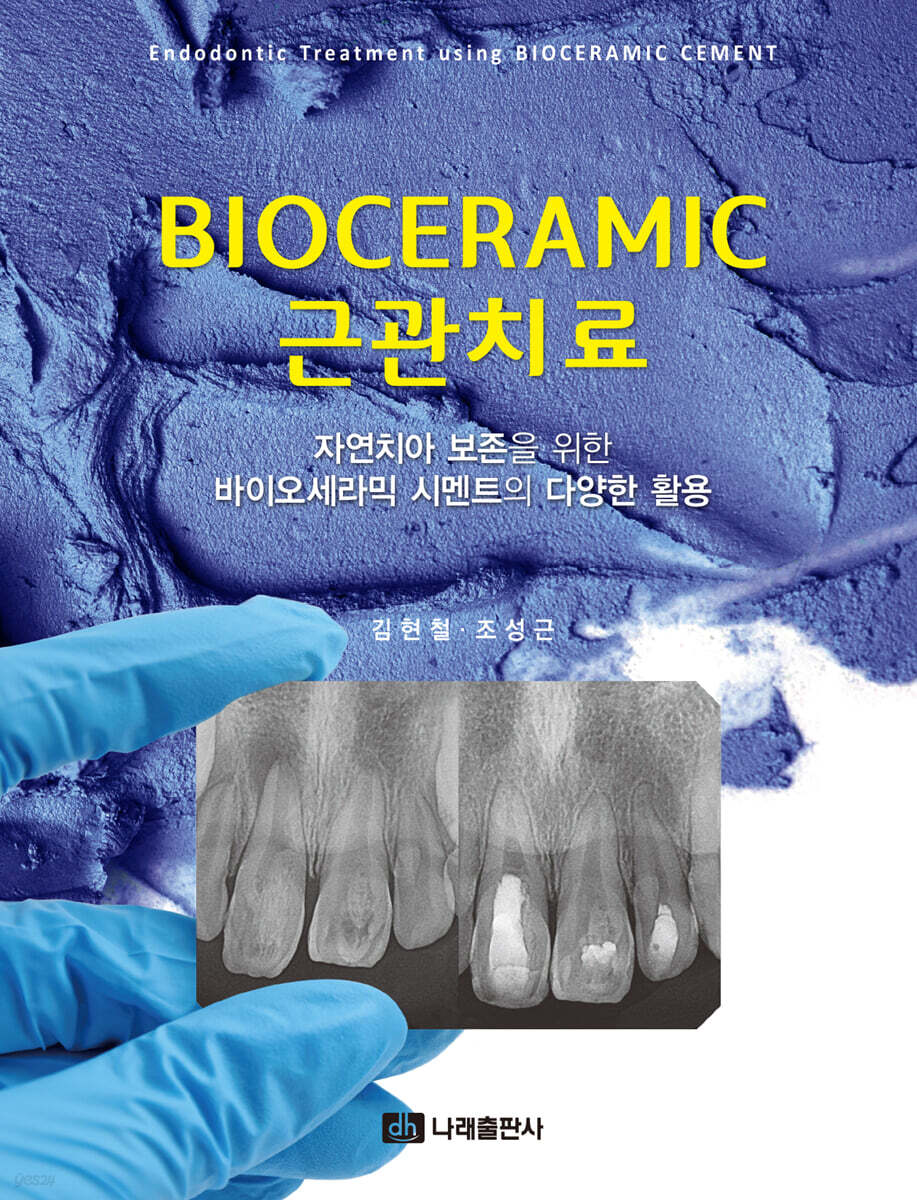 BIOCERAMIC 근관치료