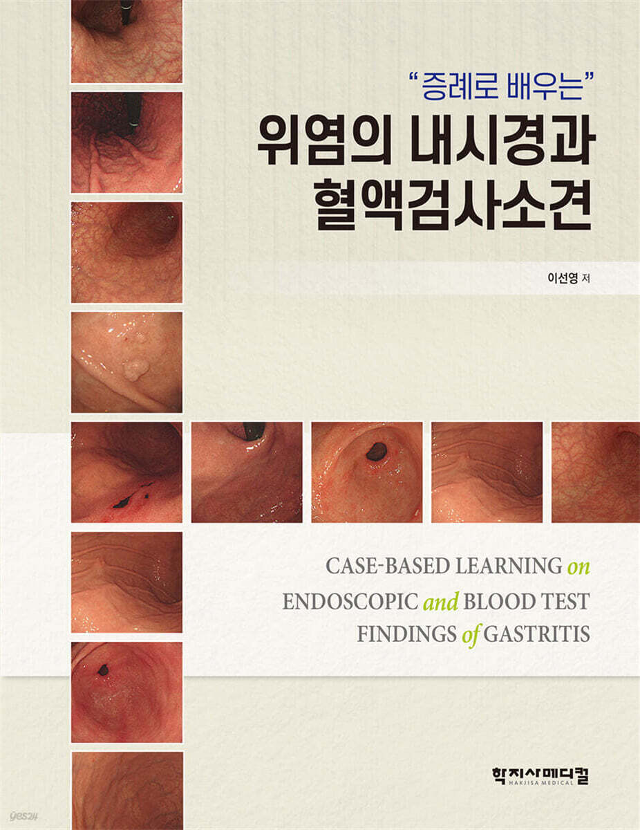 위염의 내시경과 혈액검사소견