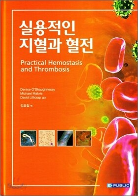실용적인 지혈과 혈전