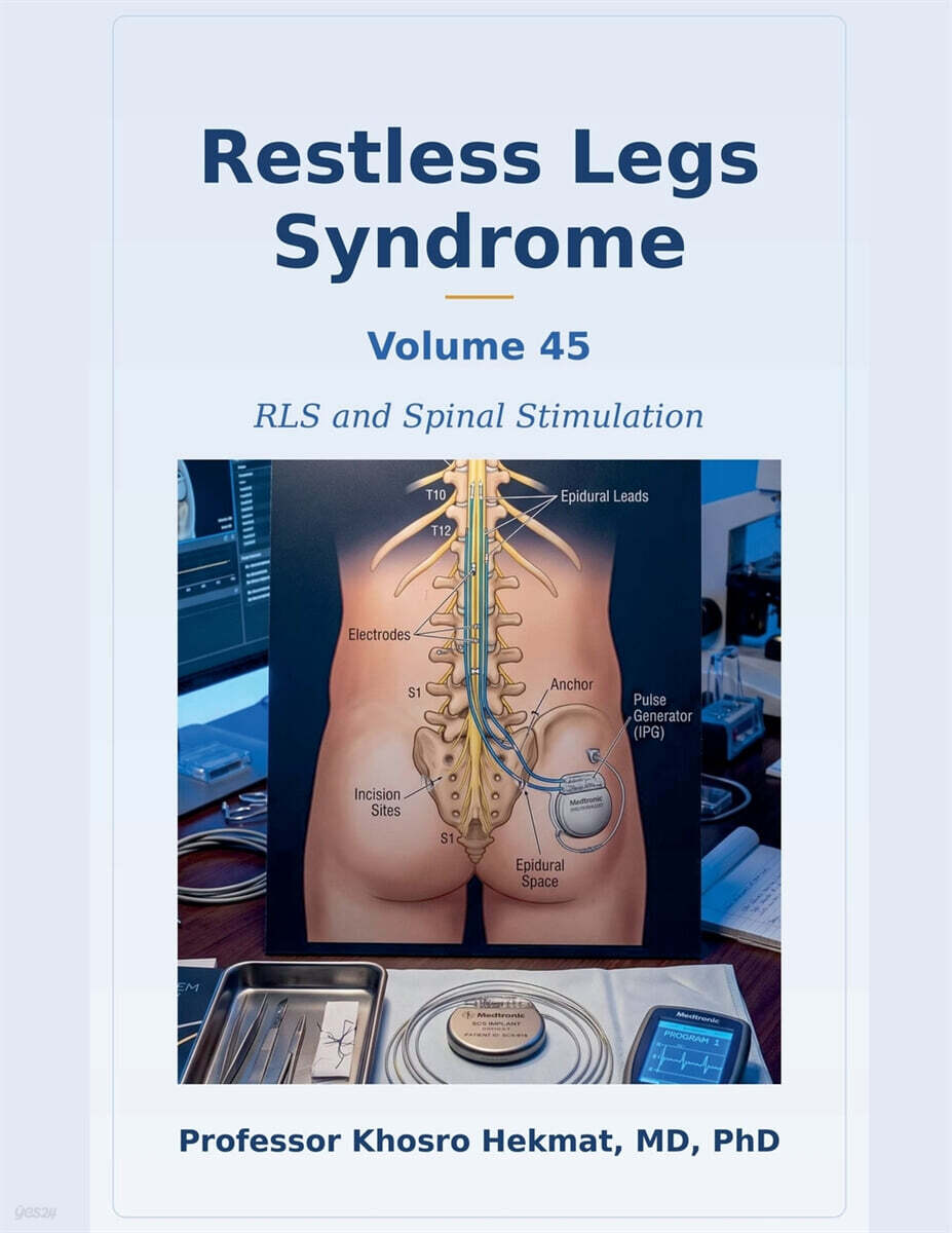 Restless Legs Syndrome - RLS and Spinal  Stimulation