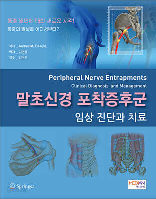 말초신경 포착증후군