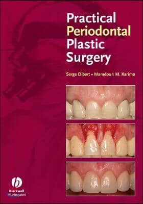 Practical Periodontal Plastic Surgery