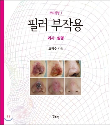 일조각  필러 부작용 - 괴사 실명