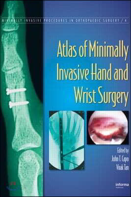 Atlas of Minimally Invasive Hand and Wrist Surgery | Capo | CRC
