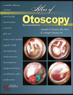 Atlas of Otoscopy