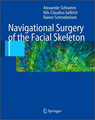 Navigational Surgery of the Facial Skeleton And Skull Base