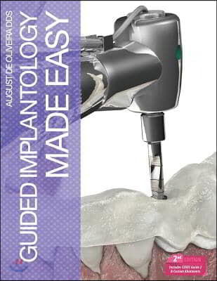 Guided Implantology Made Easy