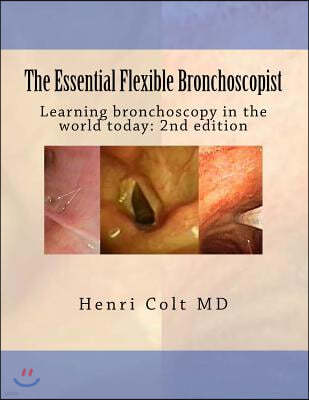 The Essential Flexible Bronchoscopist: Learning bronchoscopy in the world today