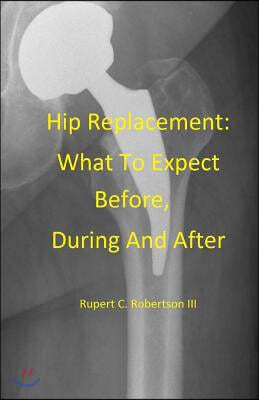 Hip Replacement: What To Expect Before, During and After