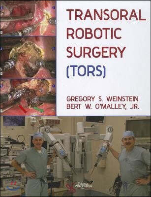 TransOral Robotic Surgery (TORS) [With DVD ROM]